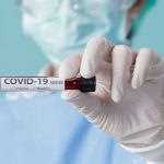 В Кыргызстане зарегистрировано 22 новых случая COVID-19. Итого — 612